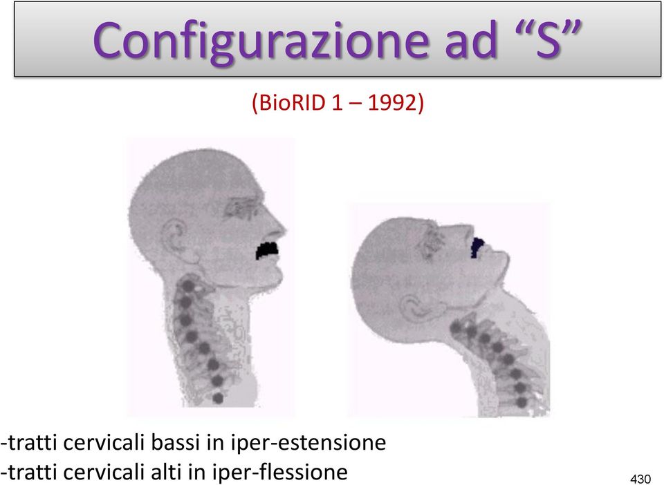 in iper-estensione -tratti