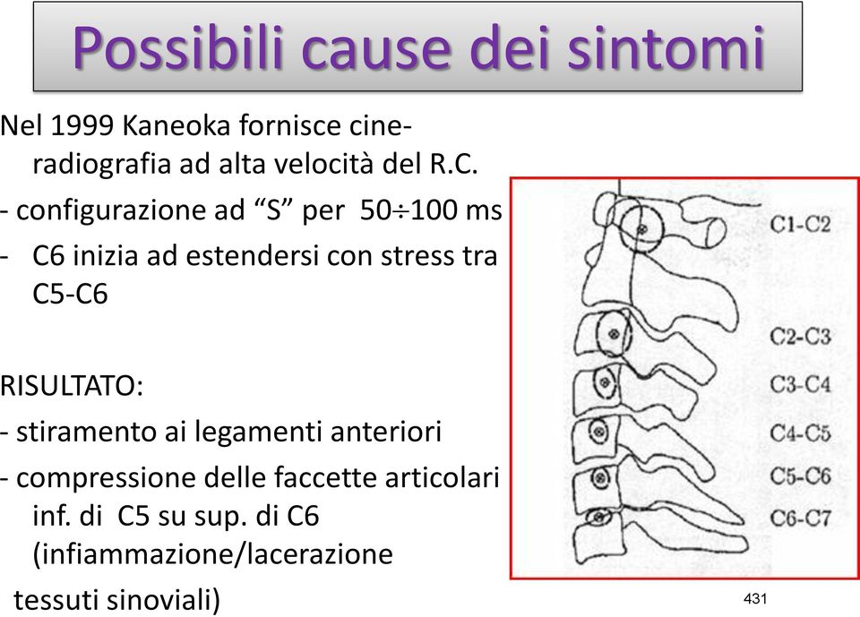 - configurazione ad S per 50 100 ms - C6 inizia ad estendersi con stress tra C5-C6