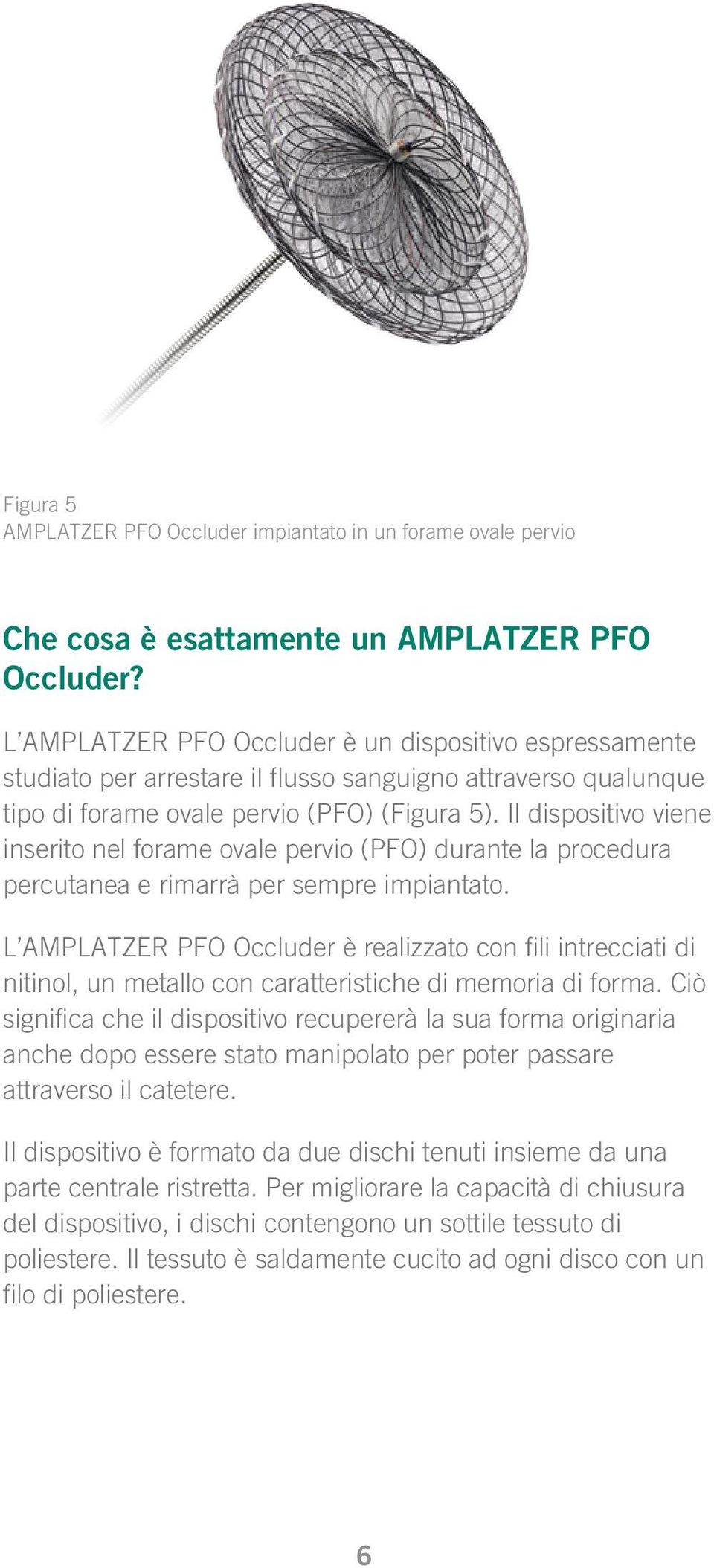 Il dispositivo viene inserito nel forame ovale pervio (PFO) durante la procedura percutanea e rimarrà per sempre impiantato.