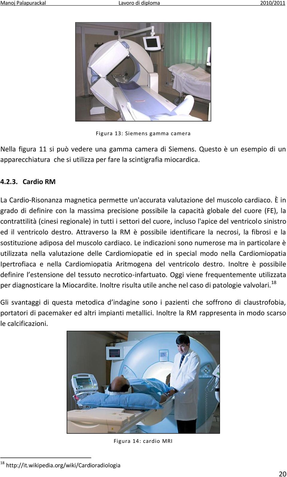 sinistro ed il ventricolo destro. Attraverso la RM è possibile identificare la necrosi, la fibrosi e la sostituzione adiposa del muscolo cardiaco.