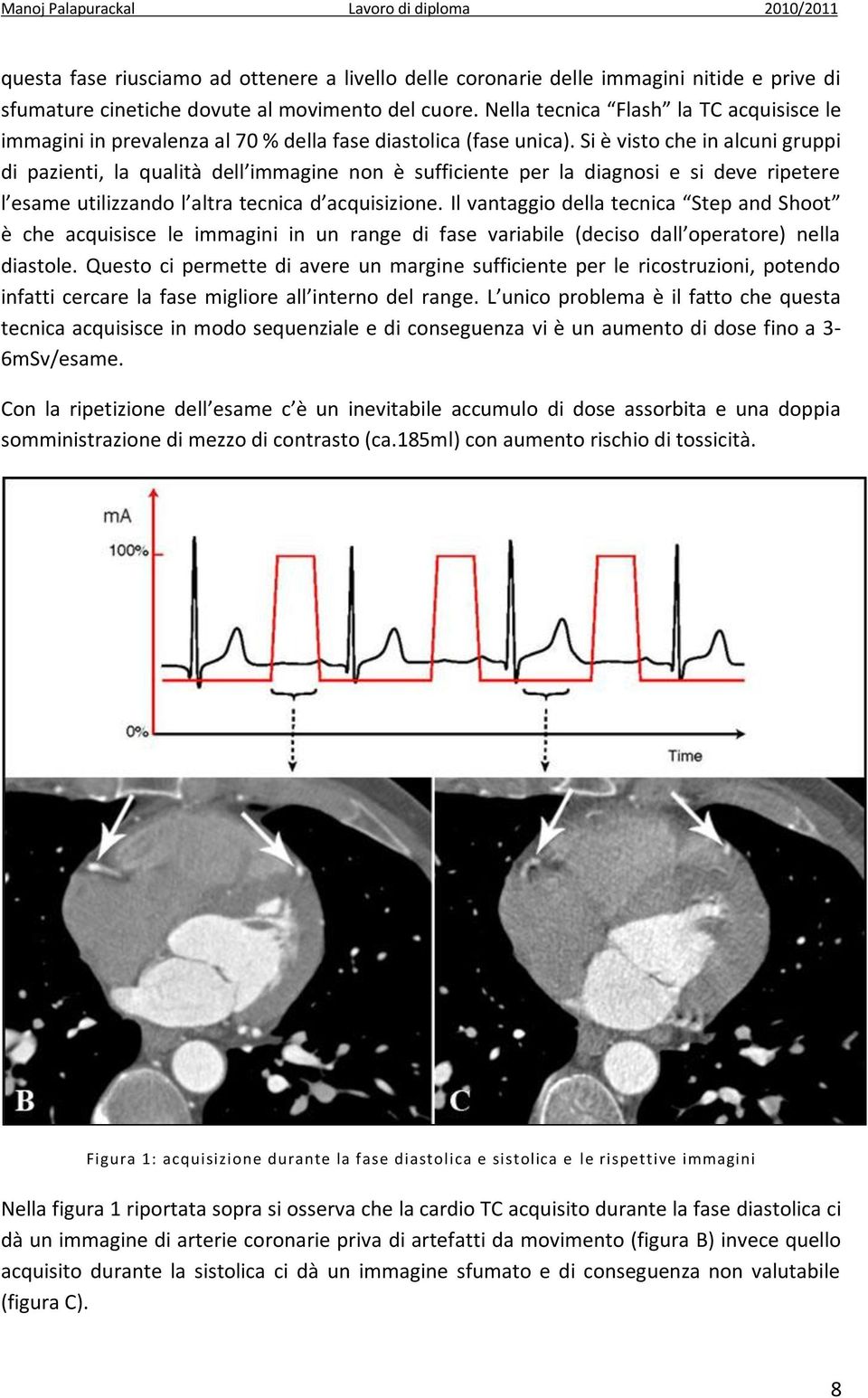 Si è visto che in alcuni gruppi di pazienti, la qualità dell immagine non è sufficiente per la diagnosi e si deve ripetere l esame utilizzando l altra tecnica d acquisizione.