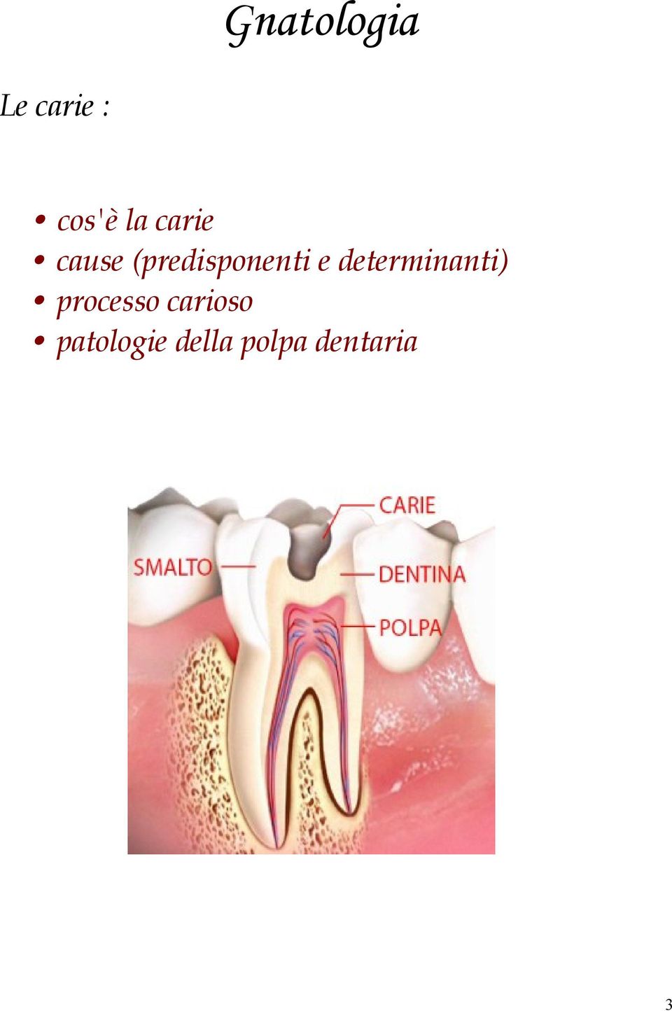 determinanti) processo carioso