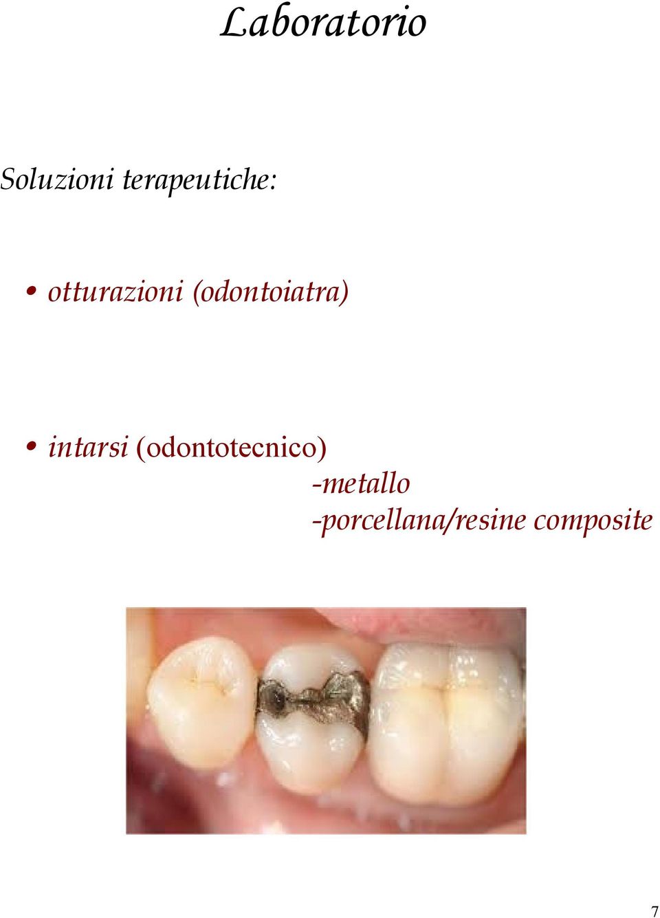 (odontoiatra) intarsi