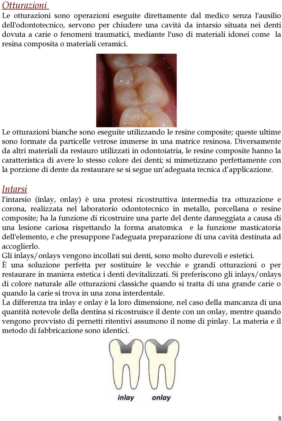 Le otturazioni bianche sono eseguite utilizzando le resine composite; queste ultime sono formate da particelle vetrose immerse in una matrice resinosa.