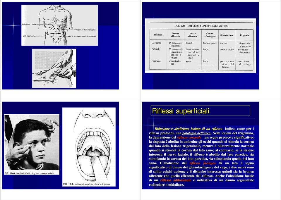 trigeminale, mentre è bilateralmente normale quando si stimola la cornea dal lato sano; al contrario, se la lesione interessa il nervo faciale, il riflesso è abolito dal lato paretico, sia stimolando