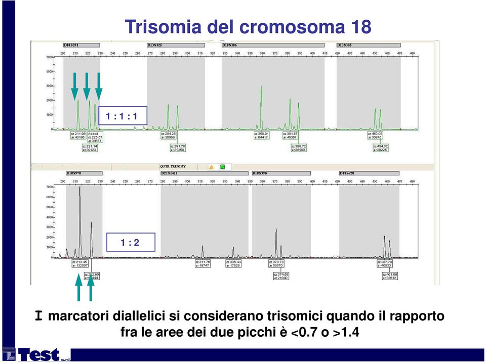 considerano trisomici quando il