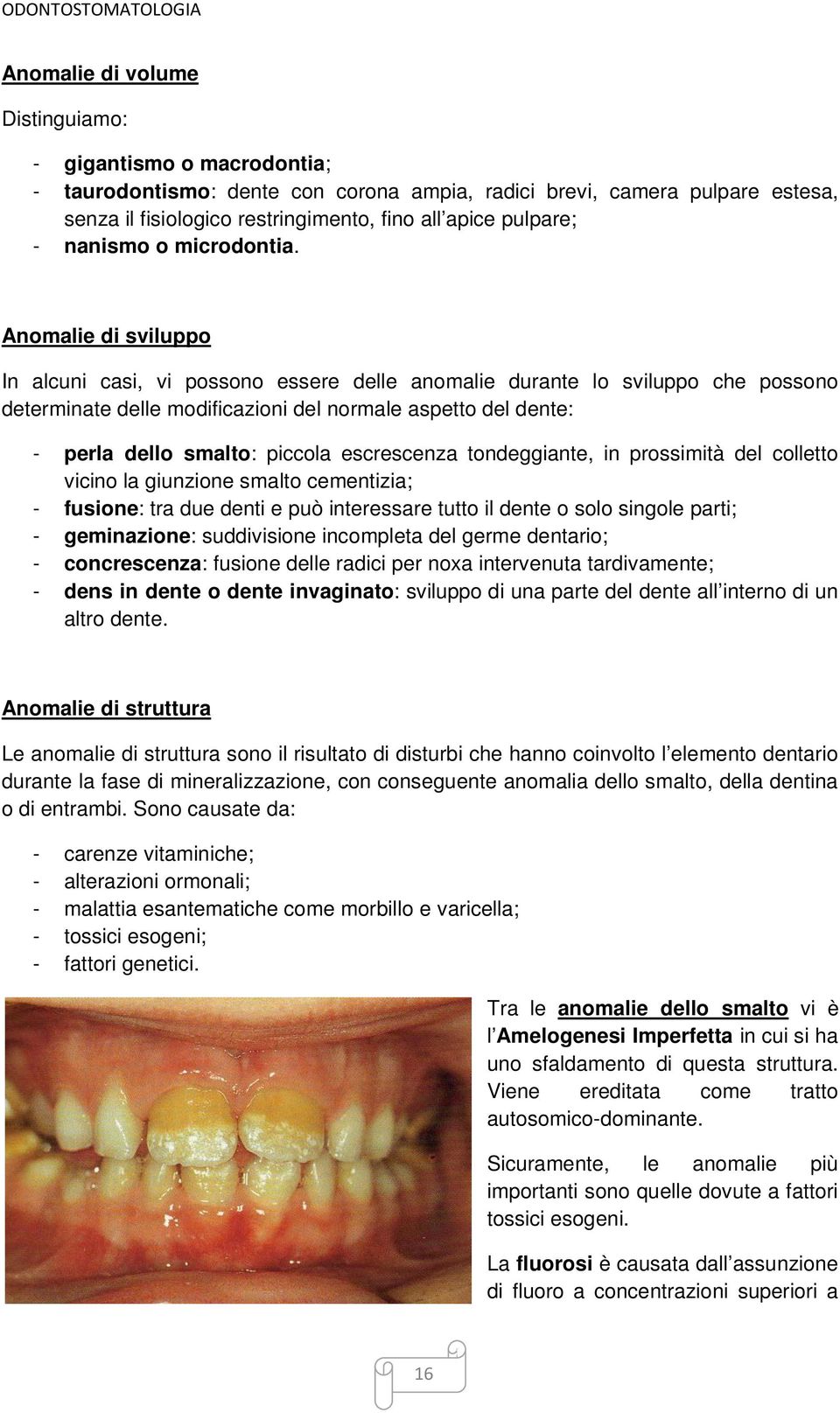 Anomalie di sviluppo In alcuni casi, vi possono essere delle anomalie durante lo sviluppo che possono determinate delle modificazioni del normale aspetto del dente: - perla dello smalto: piccola