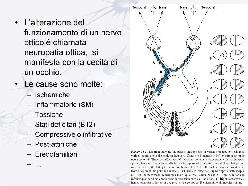 Le cause sono molte: Ischemiche Infiammatorie (SM) Tossiche Stati