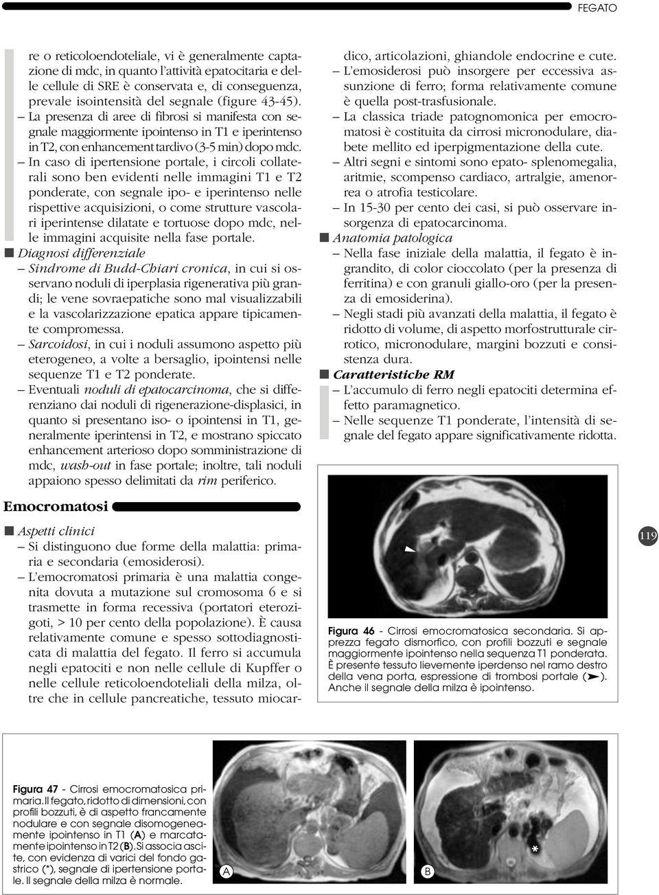 In caso di ipertensione portale, i circoli collaterali sono ben evidenti nelle immagini T1 e T2 ponderate, con segnale ipo- e iperintenso nelle rispettive acquisizioni, o come strutture vascolari