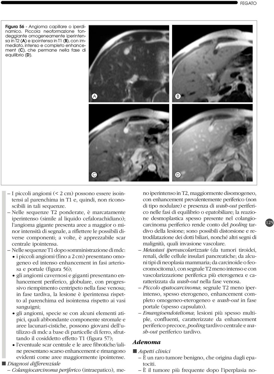 A B C I piccoli angiomi (< 2 cm) possono essere isointensi al parenchima in T1 e, quindi, non riconoscibili in tali sequenze.