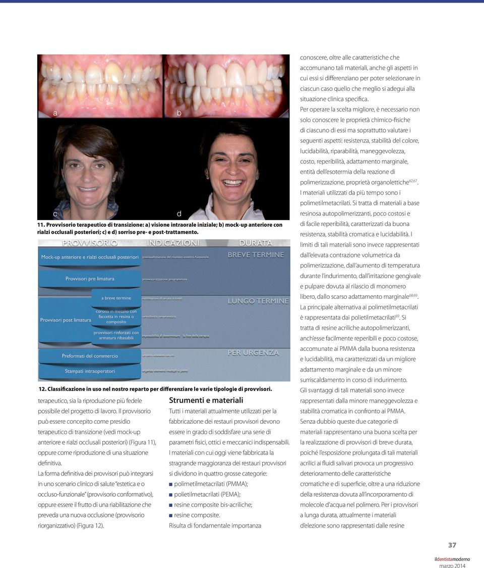 Il provvisorio Tutti i materiali attualmente utilizzati per la può essere concepito come presidio fabbricazione dei restauri provvisori devono terapeutico di transizione (vedi mock-up essere in grado