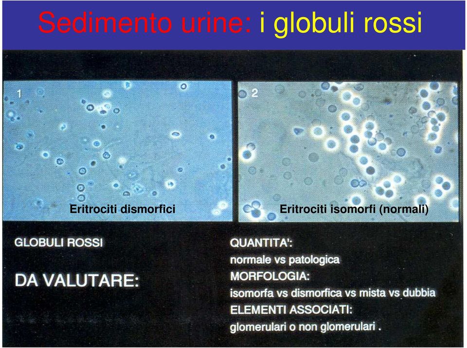 Eritrociti