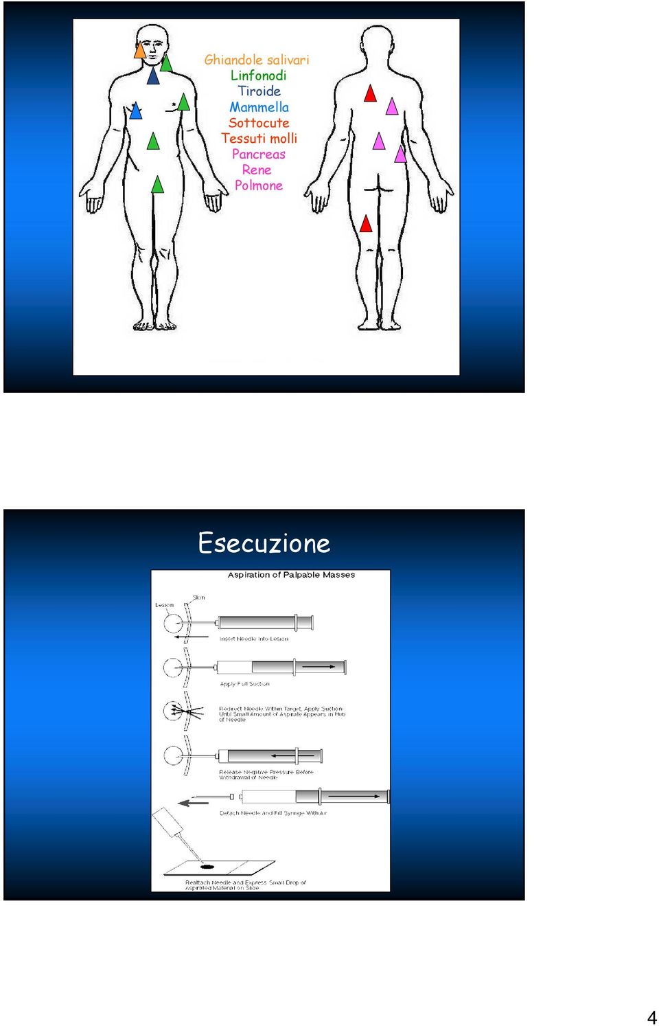 Tessuti molli Pancreas Rene