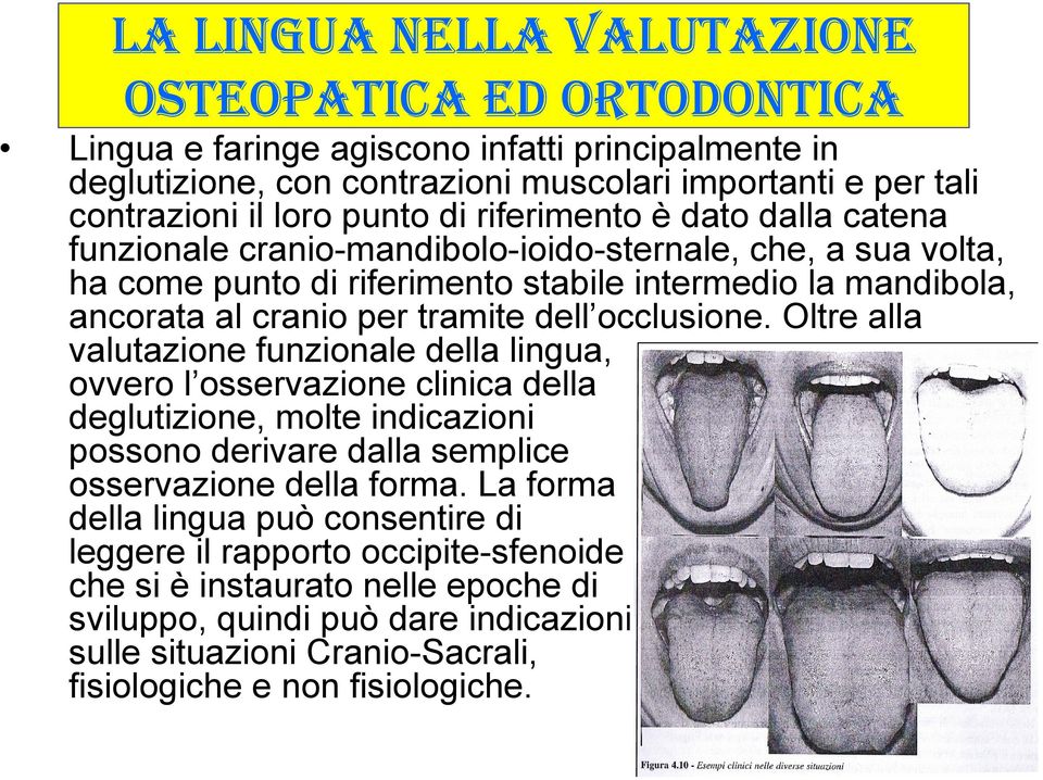 occlusione. Oltre alla valutazione funzionale della lingua, ovvero l osservazione clinica della deglutizione, molte indicazioni possono derivare dalla semplice osservazione della forma.