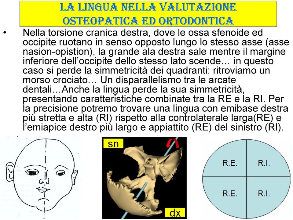 ritroviamo un morso crociato Un disparallelismo tra le arcate dentali Anche la lingua perde la sua simmetricità, presentando caratteristiche combinate tra la RE e la RI.