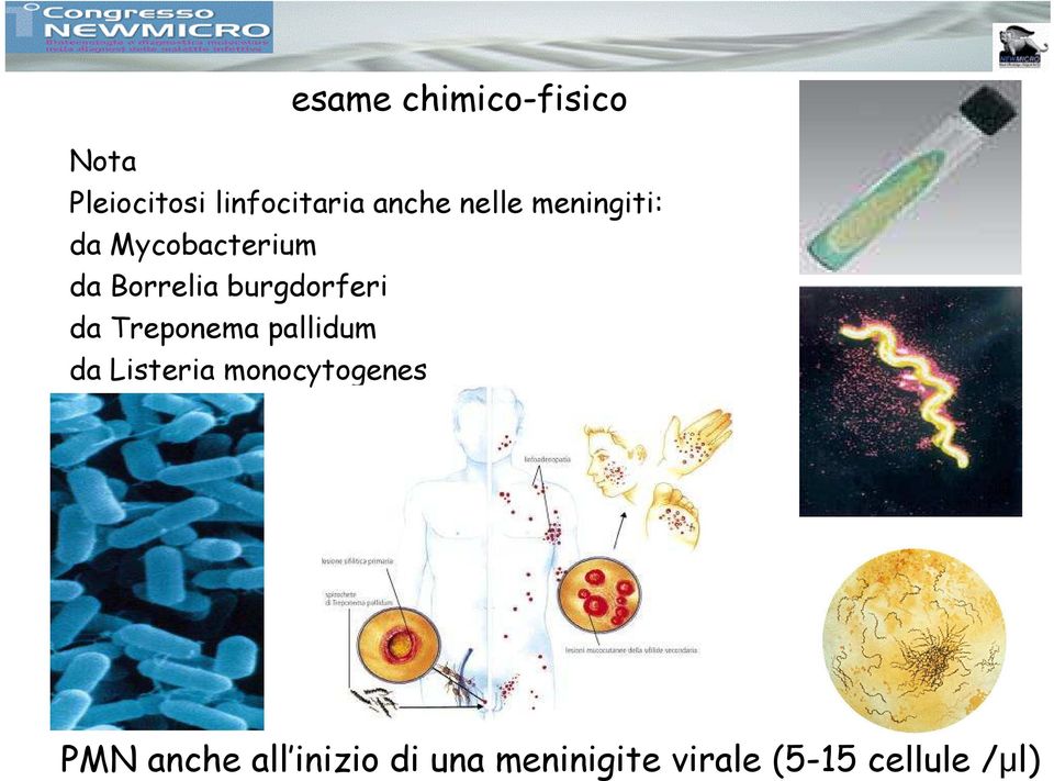 burgdorferi da Treponema pallidum da Listeria