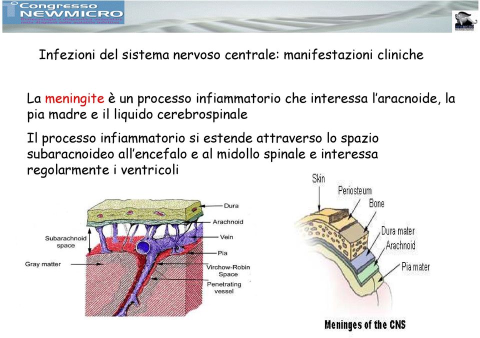 cerebrospinale Il processo infiammatorio si estende attraverso lo spazio