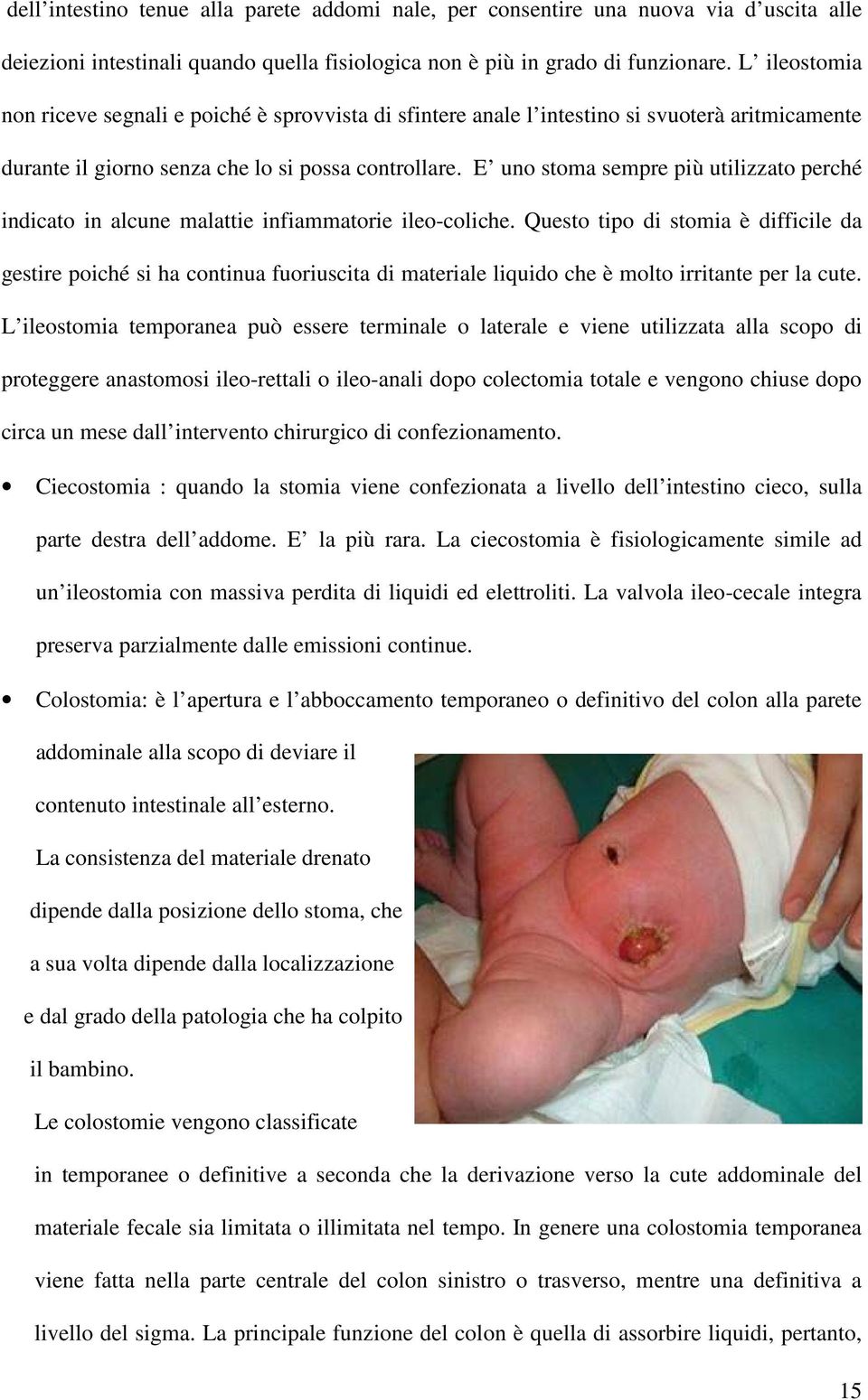 E uno stoma sempre più utilizzato perché indicato in alcune malattie infiammatorie ileo-coliche.