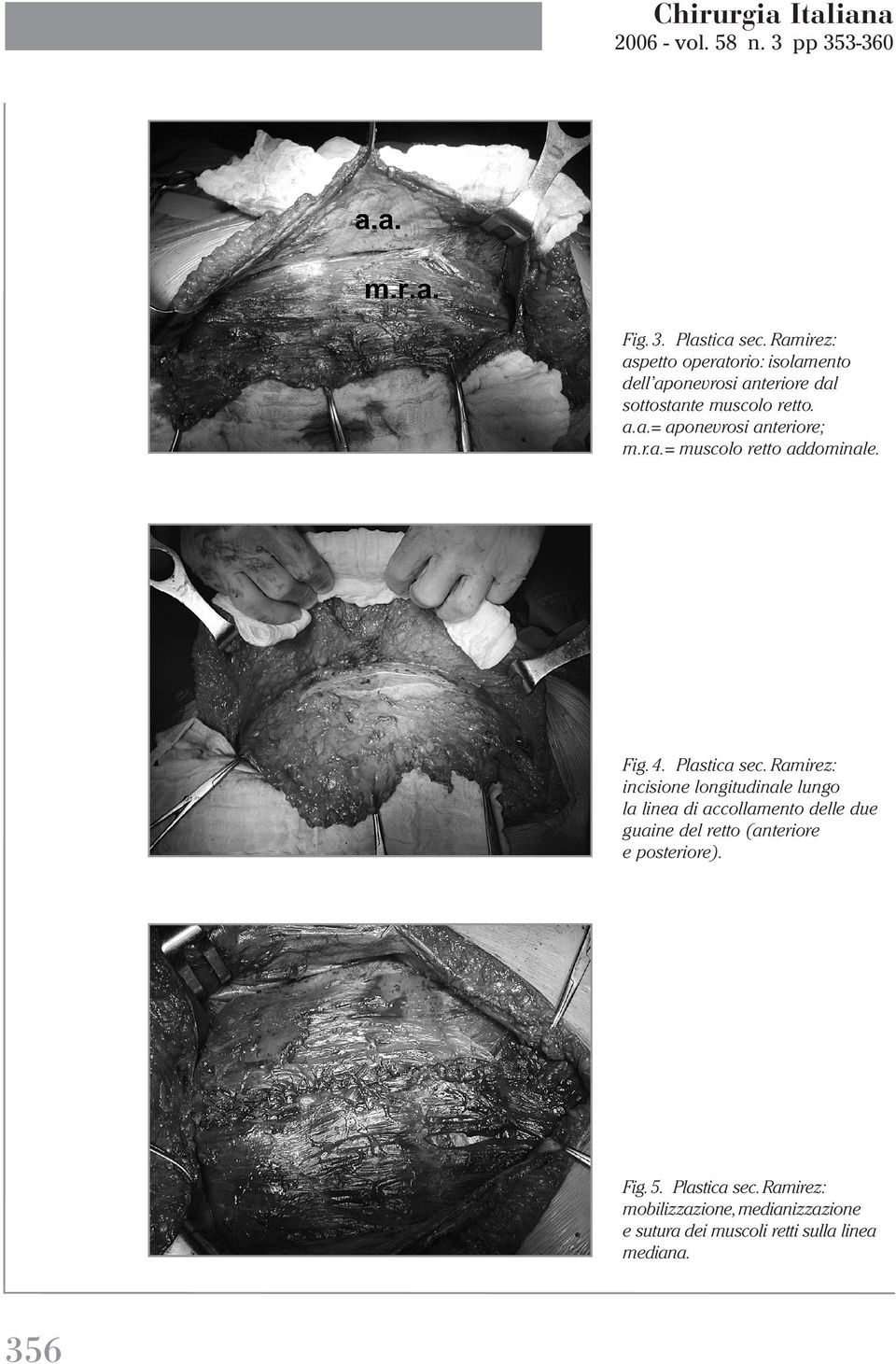 Fig. 4. Plastica sec.