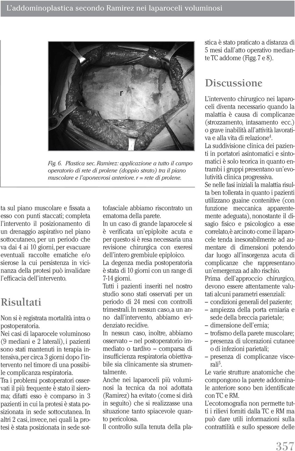 respiratoria. Tra i problemi postoperatori osservati il più frequente è stato il sieroma; difatti esso è comparso in 3 pazienti in cui la protesi è stata posizionata in sede sottocutanea.