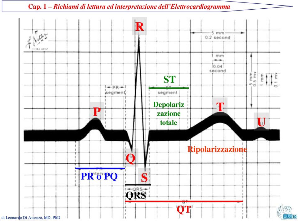 Elettrocardiogramma R ST P
