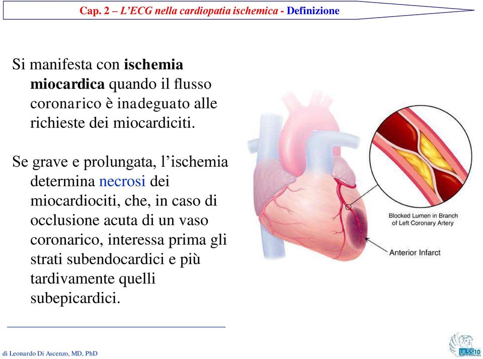 Se grave e prolungata, l ischemia determina necrosi dei miocardiociti, che, in caso di