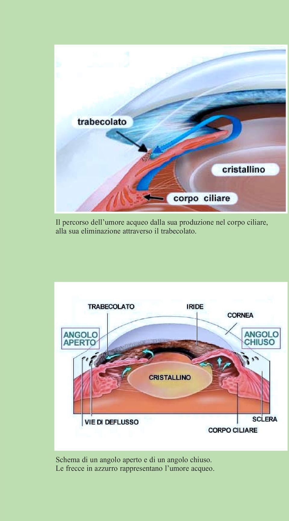 trabecolato.