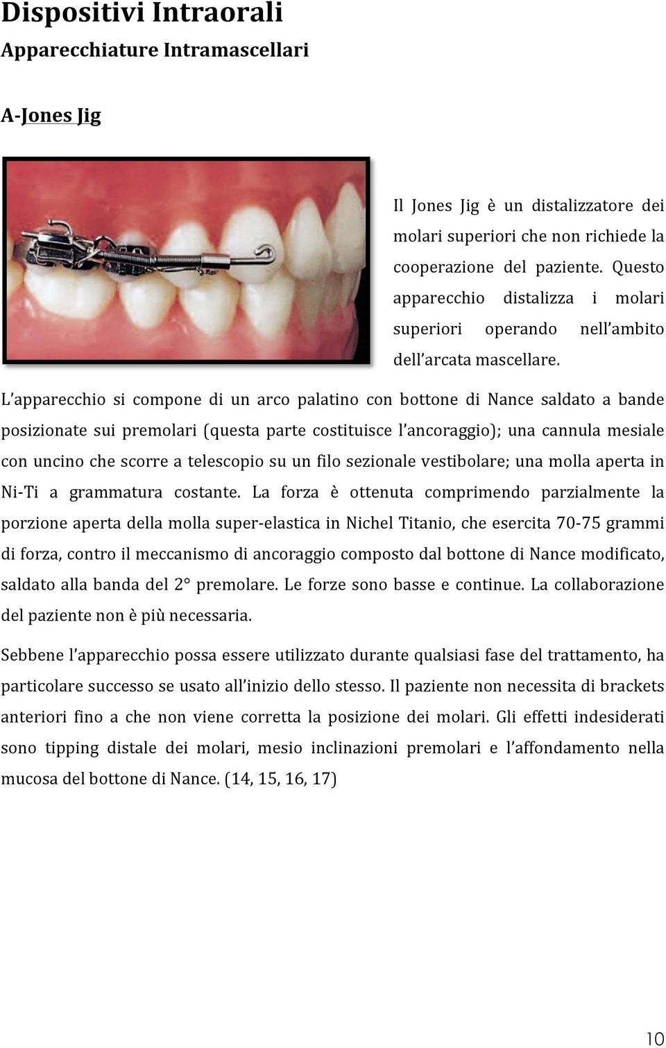 L apparecchio si compone di un arco palatino con bottone di Nance saldato a bande posizionate sui premolari (questa parte costituisce l ancoraggio); una cannula mesiale con uncino che scorre a