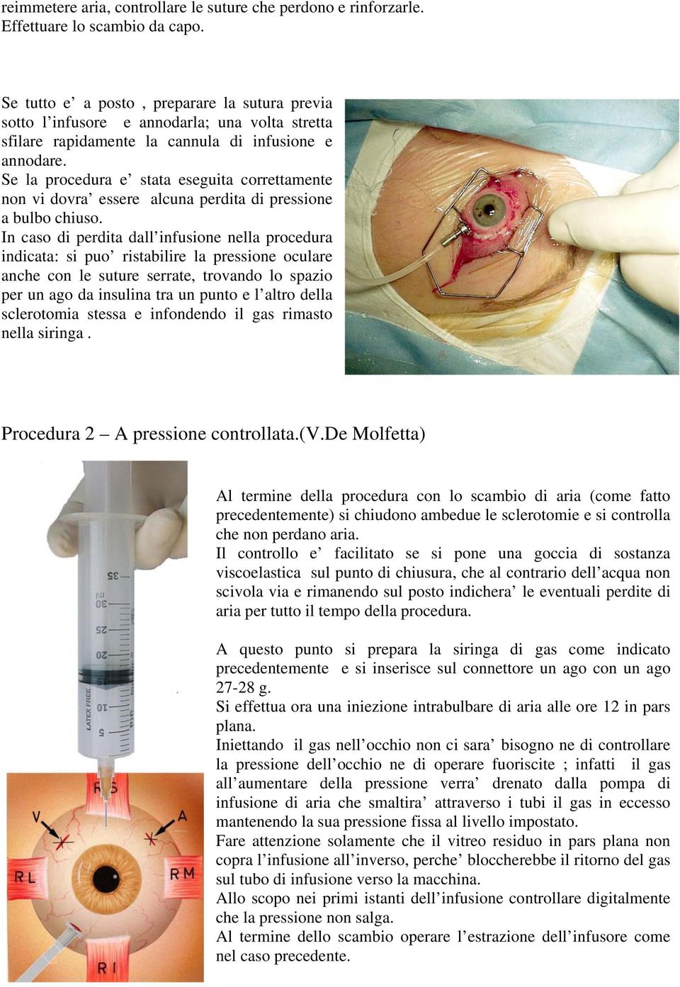 Se la procedura e stata eseguita correttamente non vi dovra essere alcuna perdita di pressione a bulbo chiuso.