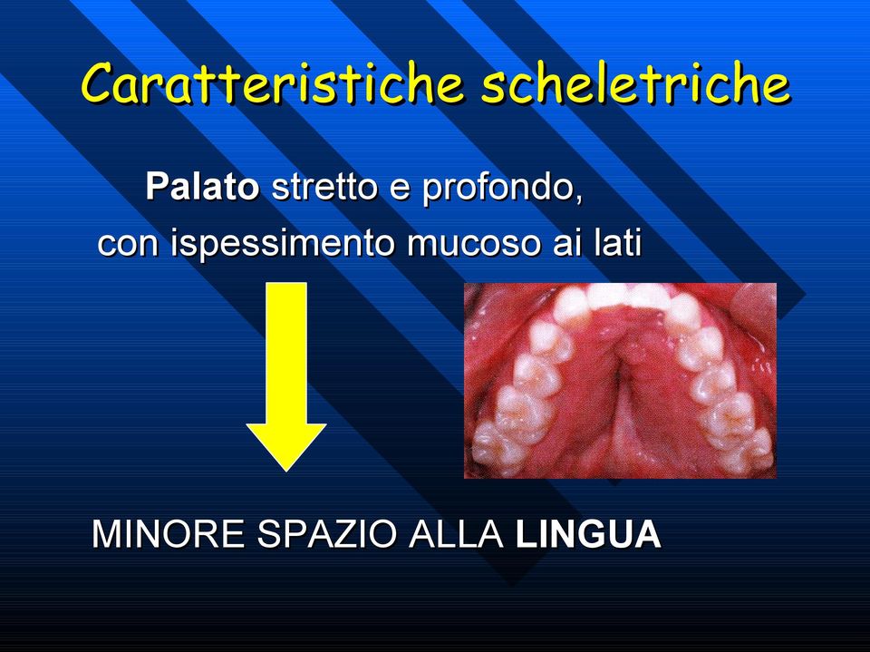 con ispessimento mucoso ai