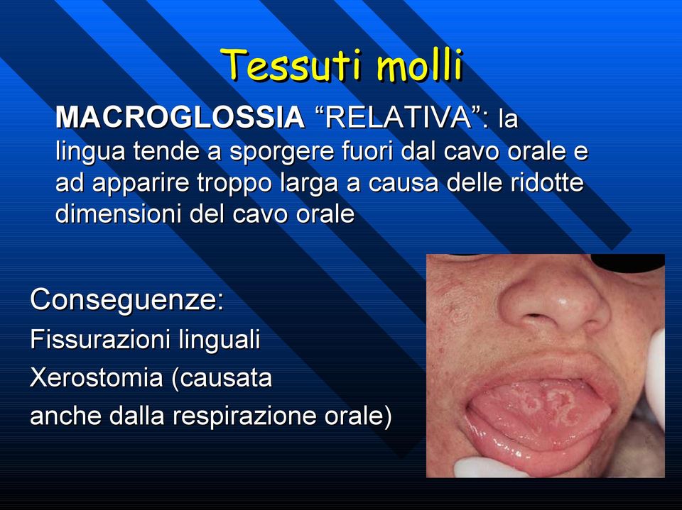 causa delle ridotte dimensioni del cavo orale Conseguenze: