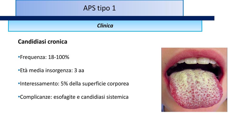 aa Interessamento: 5% della superficie