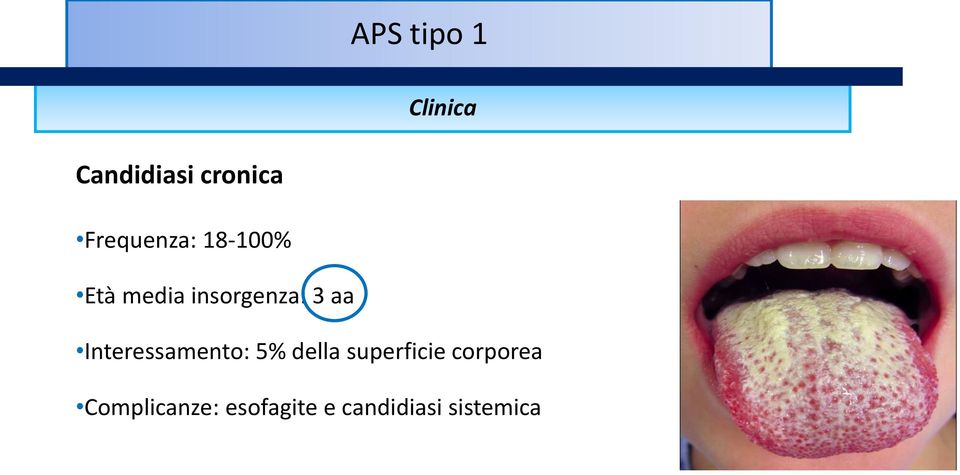 aa Interessamento: 5% della superficie