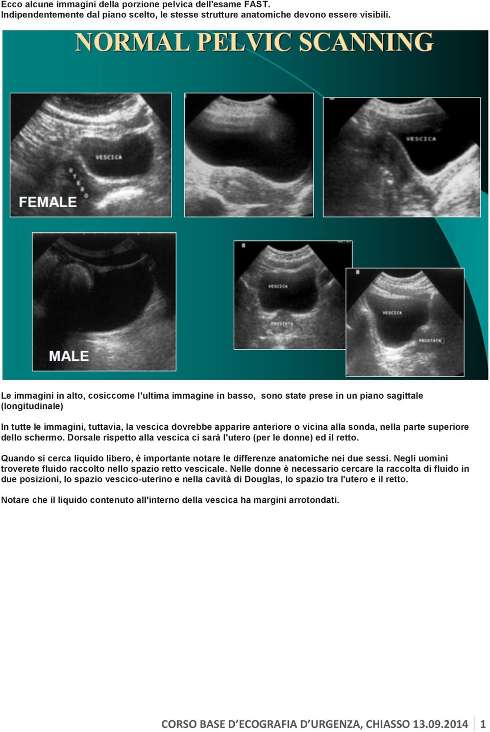 sonda, nella parte superiore dello schermo. Dorsale rispetto alla vescica ci sarà l'utero (per le donne) ed il retto.