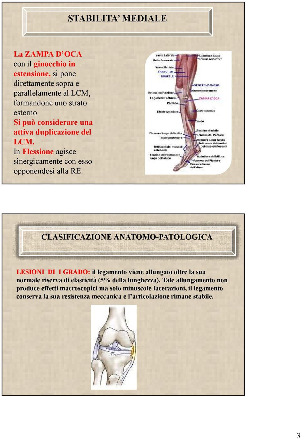 CLASIFICAZIONE ANATOMO-PATOLOGICA LESIONI DI I GRADO: il legamento viene allungato oltre la sua normale riserva di elasticità (5% della