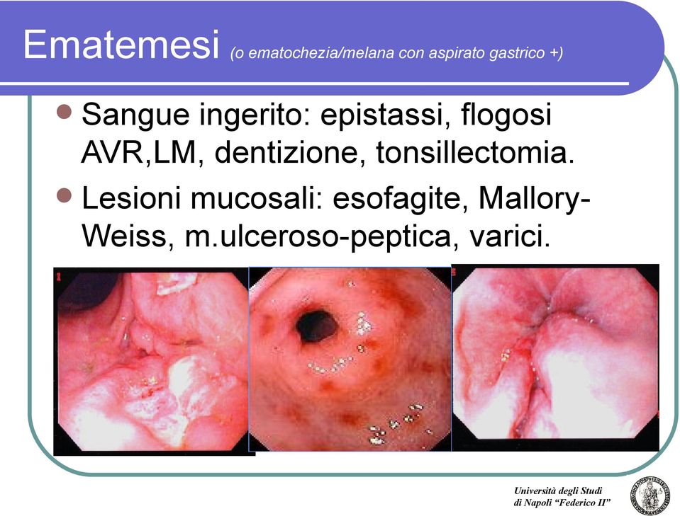 AVR,LM, dentizione, tonsillectomia.