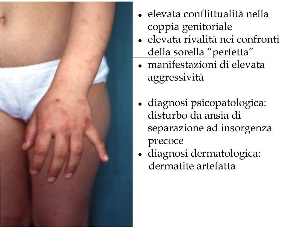 aggressività diagnosi psicopatologica: disturbo da ansia di