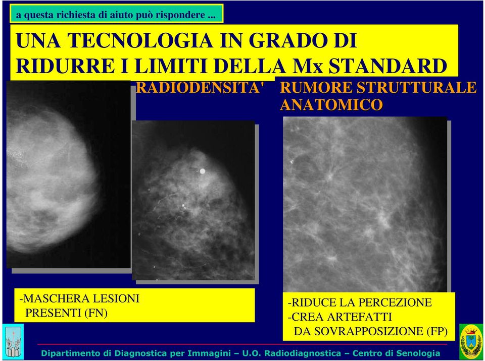 STANDARD RADIODENSITA' RUMORE STRUTTURALE ANATOMICO -MASCHERA