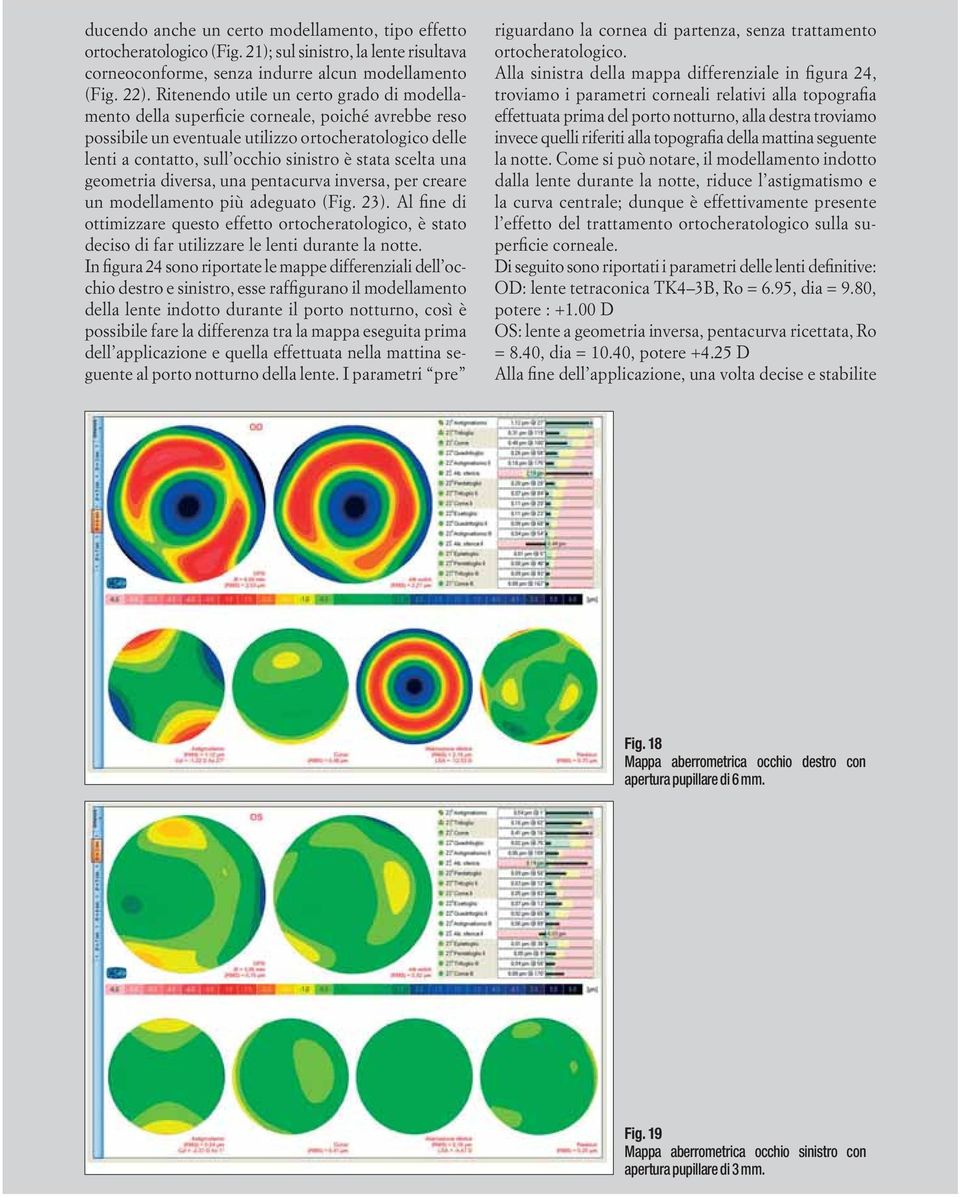 scelta una geometria diversa, una pentacurva inversa, per creare un modellamento più adeguato (Fig. 23).