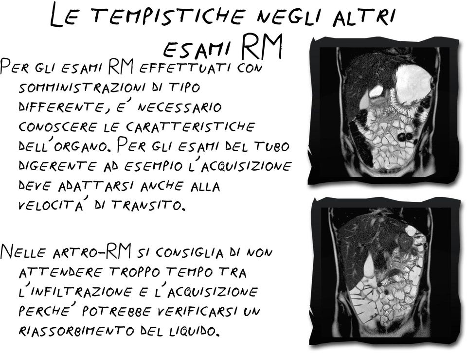 Per gli esami del tubo digerente ad esempio l acquisizione deve adattarsi anche alla velocita di