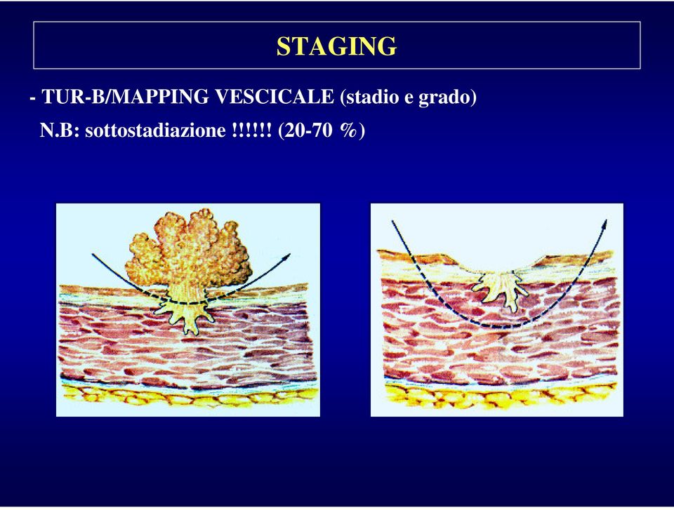 VESCICALE (stadio e