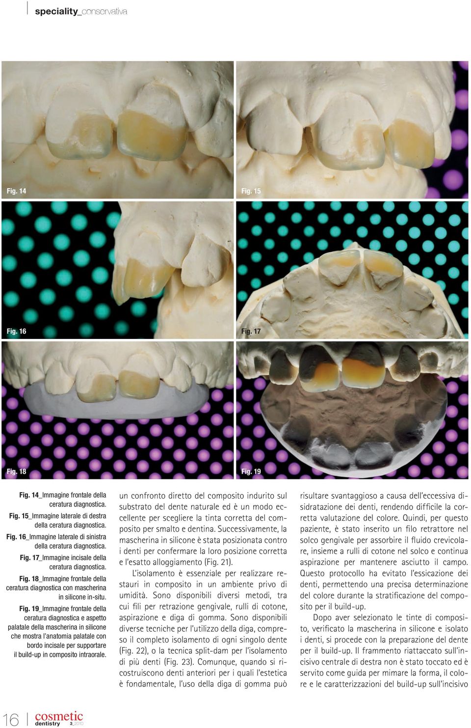 18_Immagine frontale della ceratura diagnostica con mascherina in silicone in-situ. Fig.