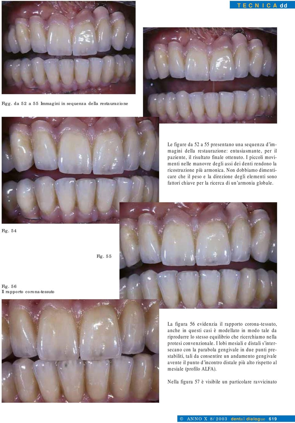 I piccoli movimenti nelle manovre degli assi dei denti rendono la ricostruzione più armonica.