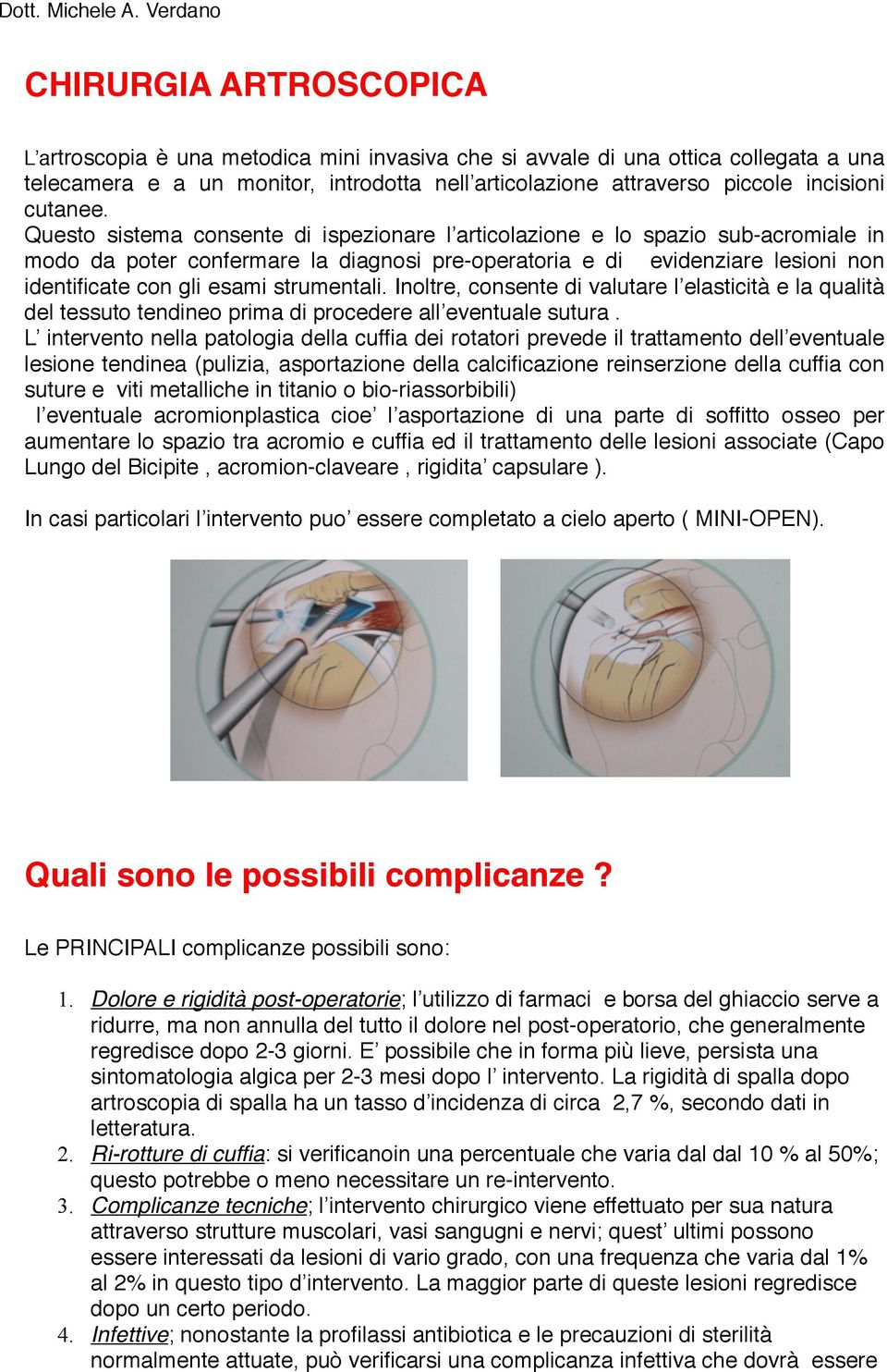 Questo sistema consente di ispezionare l articolazione e lo spazio sub-acromiale in modo da poter confermare la diagnosi pre-operatoria e di evidenziare lesioni non identificate con gli esami