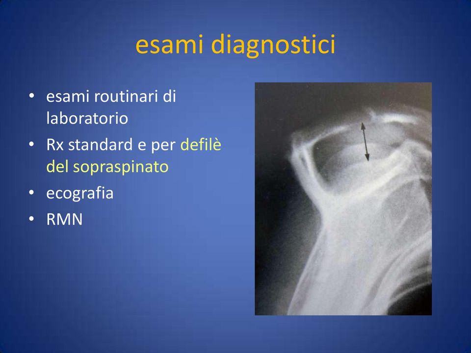 Rx standard e per defilè