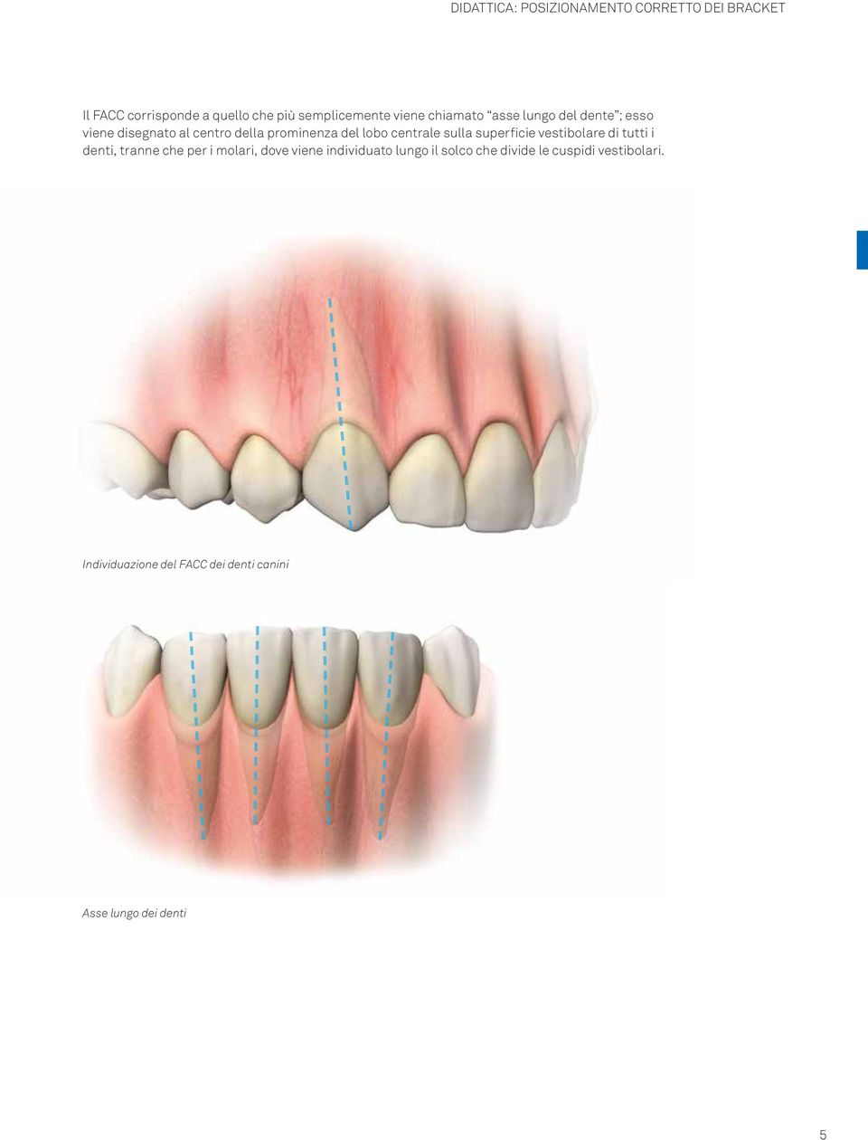 centrale sulla superficie vestibolare tutti i denti, tranne che per i molari, dove viene inviduato