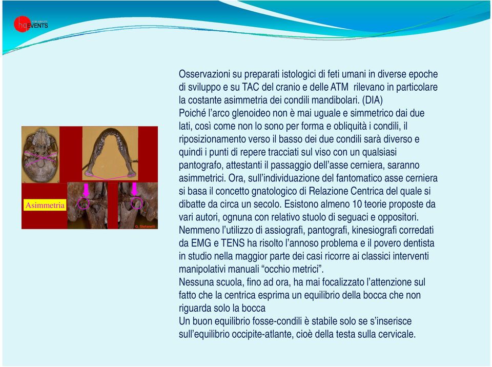 (DIA) Poiché l arco glenoideo non è mai uguale e simmetrico dai due lati, così come non lo sono per forma e obliquità i condili, il riposizionamento verso il basso dei due condili sarà diverso e