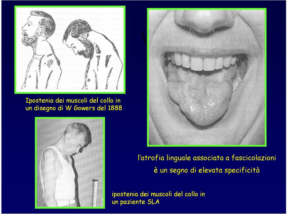 a fascicolazioni è un segno di elevata