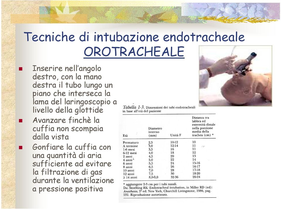 glottide Avanzare finchè la cuffia non scompaia dalla vista Gonfiare la cuffia con una