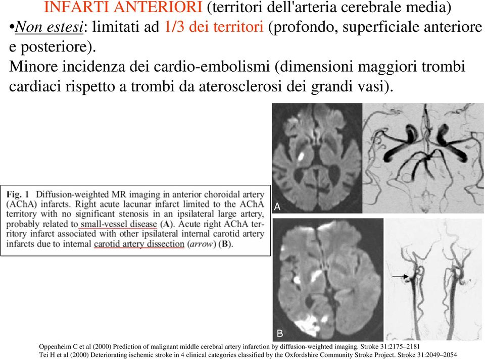 Oppenheim C et al (2000) Prediction of malignant middle cerebral artery infarction by diffusion-weighted imaging.
